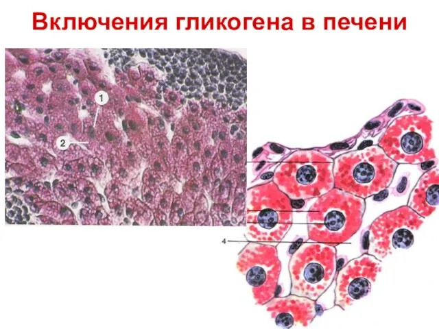 Включения гликогена в печени