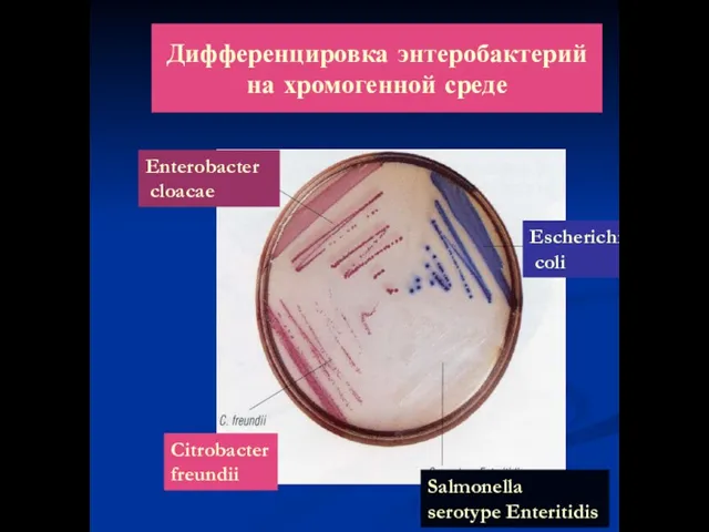 Дифференцировка энтеробактерий на хромогенной среде Enterobacter cloacae Escherichia coli Citrobacter freundii Salmonella serotype Enteritidis
