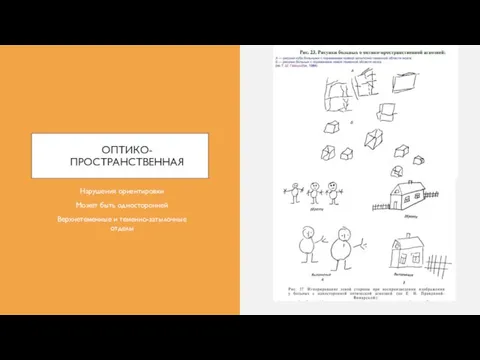 ОПТИКО-ПРОСТРАНСТВЕННАЯ Нарушения ориентировки Может быть односторонней Верхнетеменные и теменно-затылочные отделы