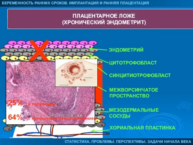 ЭНДОМЕТРИЙ ЦИТОТРОФОБЛАСТ СИНЦИТИОТРОФОБЛАСТ МЕЖВОРСИНЧАТОЕ ПРОСТРАНСТВО МЕЗОДЕРМАЛЬНЫЕ СОСУДЫ ХОРИАЛЬНАЯ ПЛАСТИНКА БЕРЕМЕННОСТЬ РАННИХ СРОКОВ.