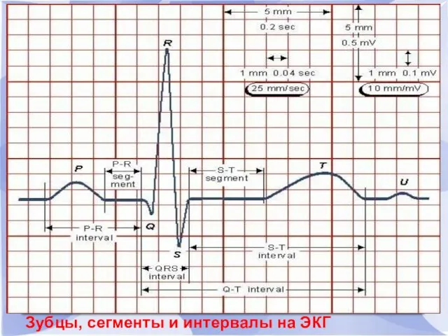 Зубцы, сегменты и интервалы на ЭКГ