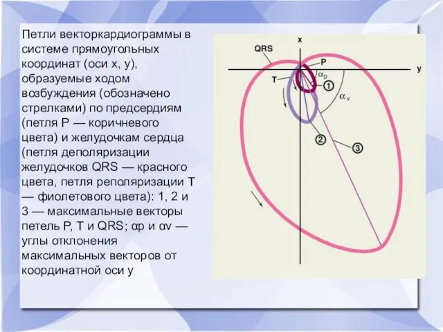 Петли векторкардиограммы в системе прямоугольных координат (оси х, у), образуемые ходом возбуждения