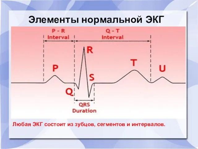 Элементы нормальной ЭКГ Любая ЭКГ состоит из зубцов, сегментов и интервалов.