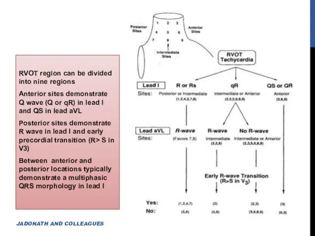 RVOT region can be divided into nine regions Anterior sites demonstrate Q