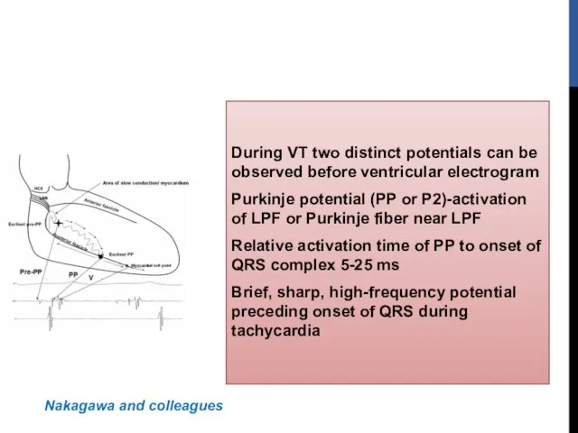 During VT two distinct potentials can be observed before ventricular electrogram Purkinje