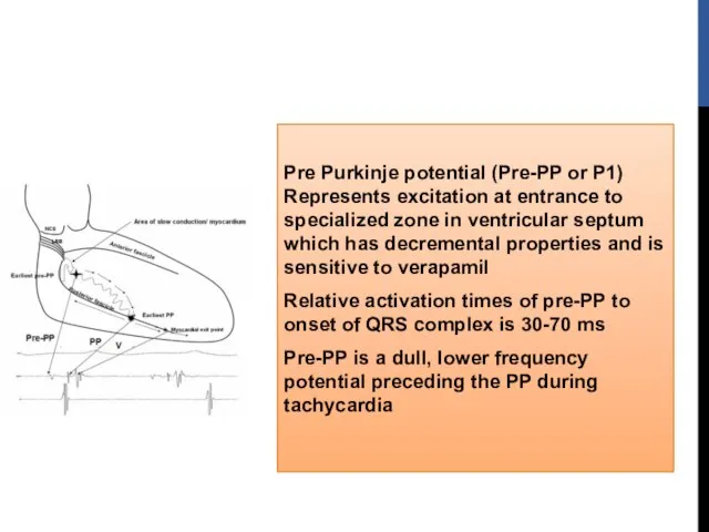 Pre Purkinje potential (Pre-PP or P1) Represents excitation at entrance to specialized