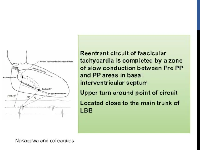 Reentrant circuit of fascicular tachycardia is completed by a zone of slow