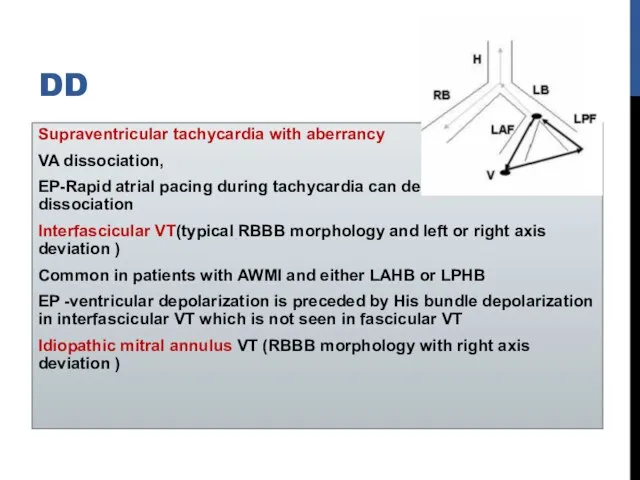 DD Supraventricular tachycardia with aberrancy VA dissociation, EP-Rapid atrial pacing during tachycardia