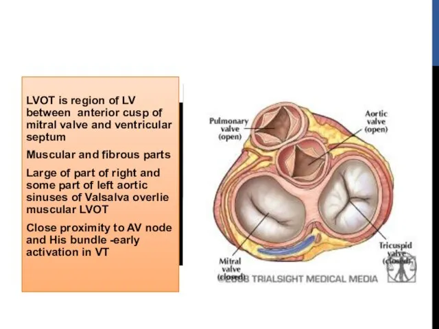 LVOT is region of LV between anterior cusp of mitral valve and