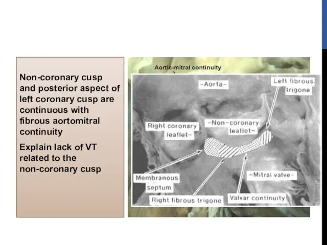 Non-coronary cusp and posterior aspect of left coronary cusp are continuous with