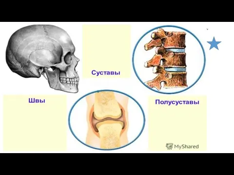 Назовите виды соединение костей, каждое соединение оценивается 1 баллом, общее кол-во -