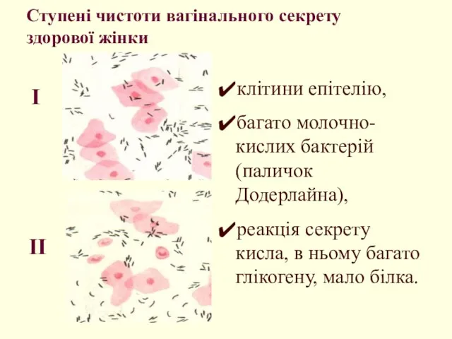 Ступені чистоти вагінального секрету здорової жінки клітини епітелію, багато молочно-кислих бактерій (паличок