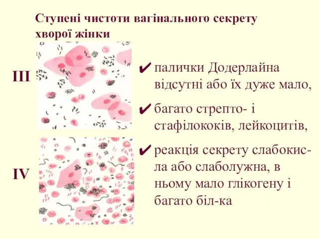 Ступені чистоти вагінального секрету хворої жінки палички Додерлайна відсутні або їх дуже