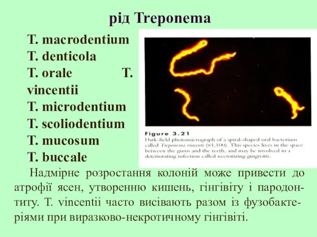 рід Treponema Т. macrodentium Т. denticola Т. orale Т. vincentii Т. microdentium