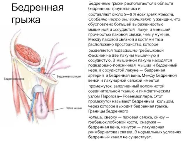 Бедренная грыжа Бедренные грыжи располагаются в области бедренного треугольника и составляют около