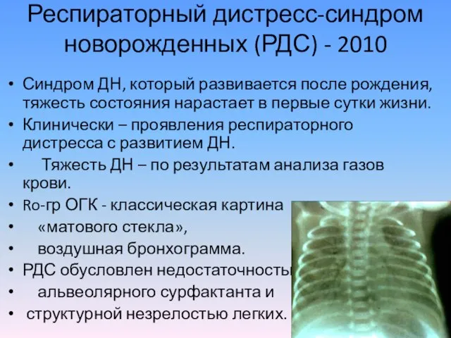 Респираторный дистресс-синдром новорожденных (РДС) - 2010 Синдром ДН, который развивается после рождения,