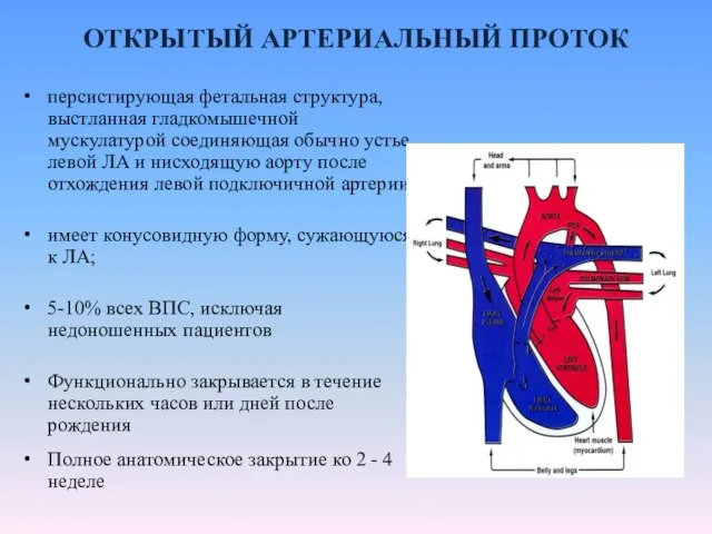 ОТКРЫТЫЙ АРТЕРИАЛЬНЫЙ ПРОТОК персистирующая фетальная структура, выстланная гладкомышечной мускулатурой соединяющая обычно устье