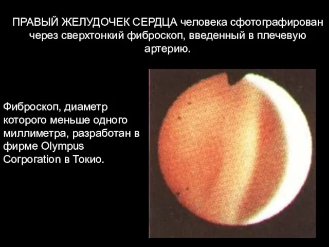 Фиброскоп, диаметр которого меньше одного миллиметра, разработан в фирме Olympus Согрогаtion в
