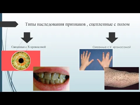 Типы наследования признаков , сцепленные с полом Связанные с Х-хромосомой Связанные с У- хромосомой