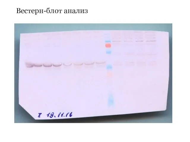Вестерн-блот анализ