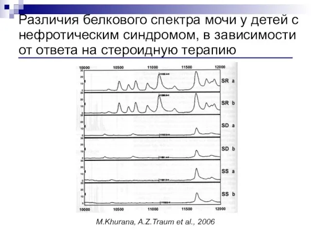 Различия белкового спектра мочи у детей с нефротическим синдромом, в зависимости от