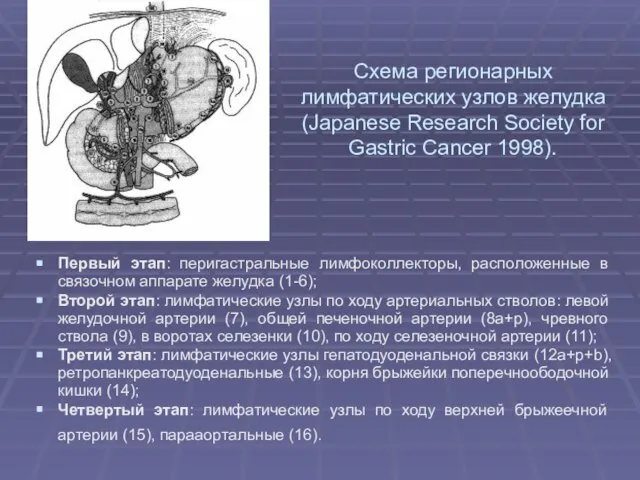 Схема регионарных лимфатических узлов желудка (Japanese Research Society for Gastric Cancer 1998).