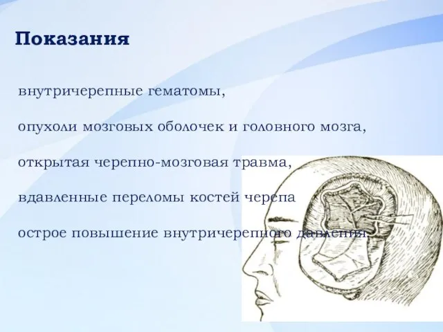 внутричерепные гематомы, опухоли мозговых оболочек и головного мозга, открытая черепно-мозговая травма, вдавленные