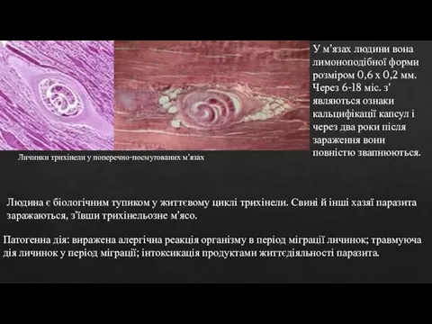 Личинки трихінели у поперечно-посмугованих м’язах У м’язах людини вона лимоноподібної форми розміром