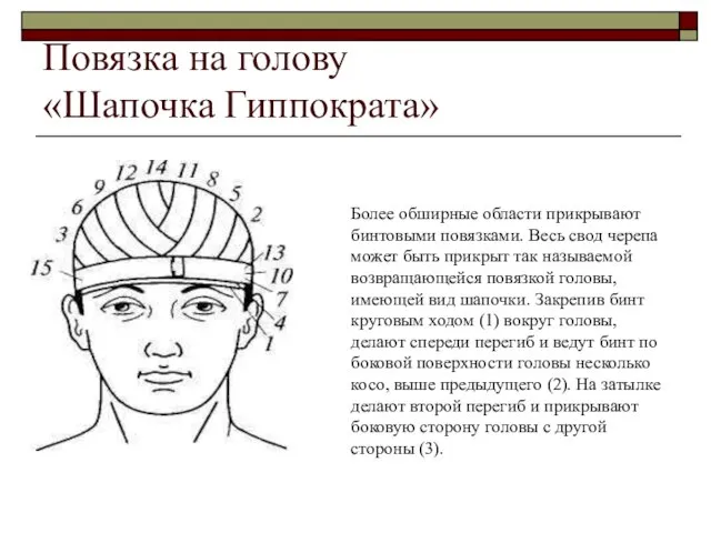 Повязка на голову «Шапочка Гиппократа» Повязка «чепец». Наиболее отвечающей современным требованиям лечения