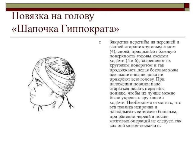 Повязка на голову «Шапочка Гиппократа» Закрепив перегибы на передней и задней стороне