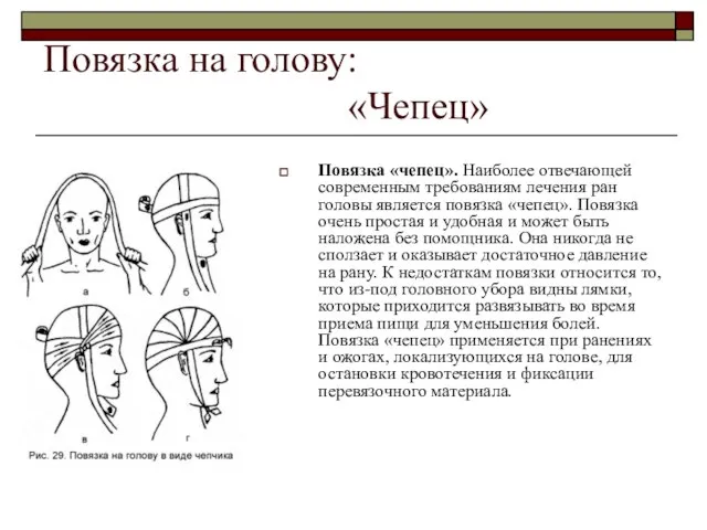 Повязка на голову: «Чепец» Повязка «чепец». Наиболее отвечающей современным требованиям лечения ран