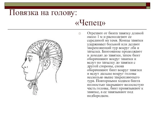 Повязка на голову: «Чепец» Отрезают от бинта завязку длиной около 1 м