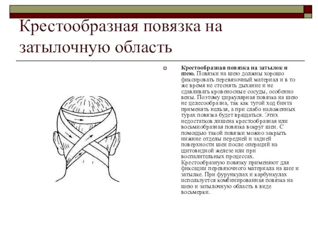 Крестообразная повязка на затылочную область Крестообразная повязка на затылок и шею. Повязки