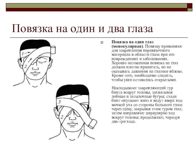 Повязка на один и два глаза Повязка на один глаз (монокулярная). Повязку