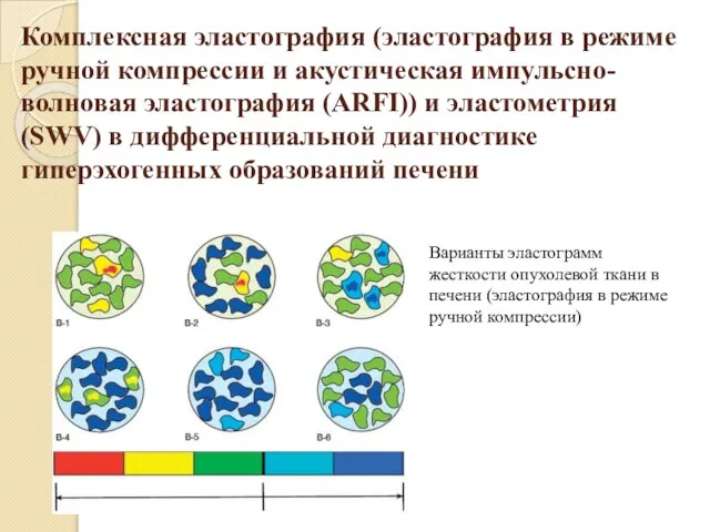 Комплексная эластография (эластография в режиме ручной компрессии и акустическая импульсно-волновая эластография (ARFI))