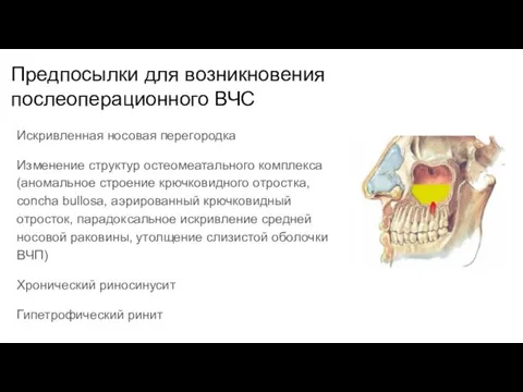 Предпосылки для возникновения послеоперационного ВЧС Искривленная носовая перегородка Изменение структур остеомеатального комплекса