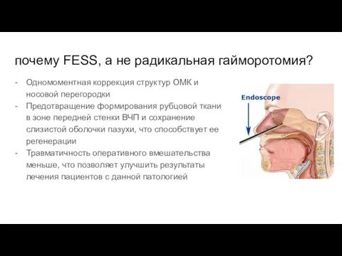 почему FESS, а не радикальная гайморотомия? Одномоментная коррекция структур ОМК и носовой