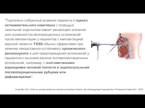 “Тщательно собранный анамнез пациента и оценка остиомеатального комплекса с помощью назальной эндоскопии