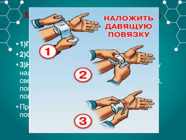 Методы остановки венозного кровотечения: 1)Пальцевое прижатие 2)Отведение и сгибание конечности 3)Наложение давящей