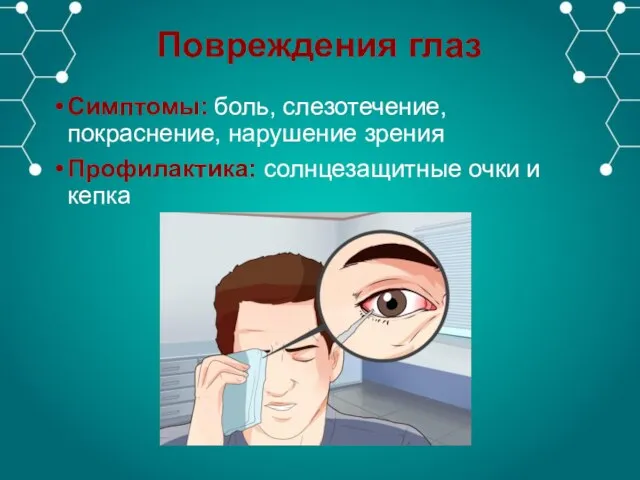 Повреждения глаз Симптомы: боль, слезотечение, покраснение, нарушение зрения Профилактика: солнцезащитные очки и кепка