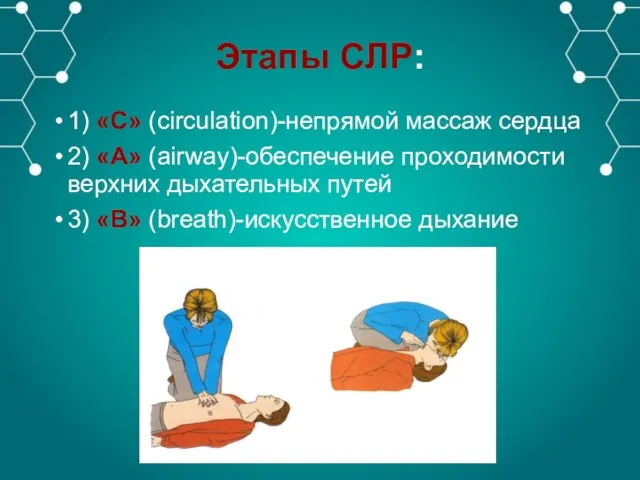 Этапы СЛР: 1) «С» (circulation)-непрямой массаж сердца 2) «А» (airway)-обеспечение проходимости верхних