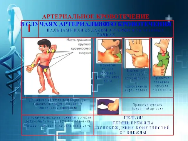АРТЕРИАЛЬНОЕ КРОВОТЕЧЕНИЕ В СЛУЧАЯХ АРТЕРИАЛЬНОГО КРОВОТЕЧЕНИЯ