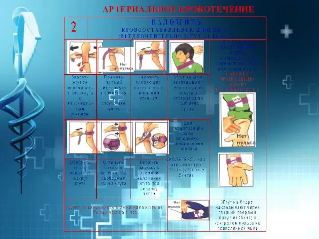 АРТЕРИАЛЬНОЕ КРОВОТЕЧЕНИЕ