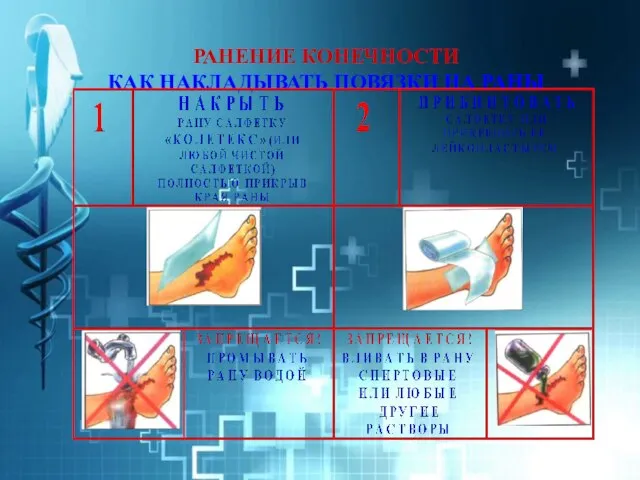 РАНЕНИЕ КОНЕЧНОСТИ КАК НАКЛАДЫВАТЬ ПОВЯЗКИ НА РАНЫ