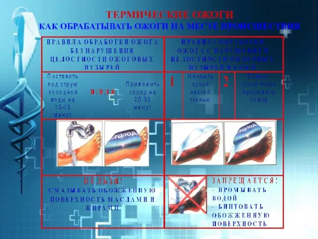 ТЕРМИЧЕСКИЕ ОЖОГИ КАК ОБРАБАТЫВАТЬ ОЖОГИ НА МЕСТЕ ПРОИСШЕСТВИЯ