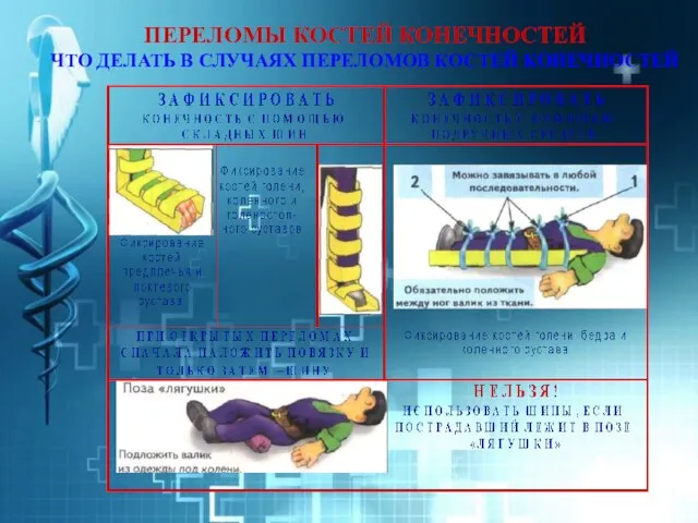 ПЕРЕЛОМЫ КОСТЕЙ КОНЕЧНОСТЕЙ ЧТО ДЕЛАТЬ В СЛУЧАЯХ ПЕРЕЛОМОВ КОСТЕЙ КОНЕЧНОСТЕЙ