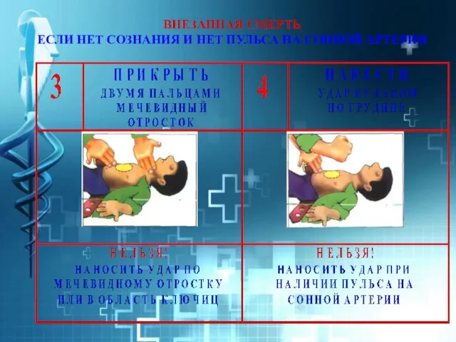 ВНЕЗАПНАЯ СМЕРТЬ ЕСЛИ НЕТ СОЗНАНИЯ И НЕТ ПУЛЬСА НА СОННОЙ АРТЕРИИ