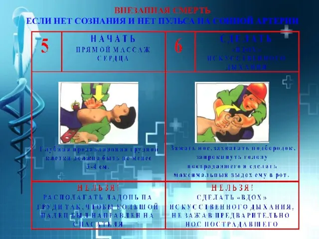 ВНЕЗАПНАЯ СМЕРТЬ ЕСЛИ НЕТ СОЗНАНИЯ И НЕТ ПУЛЬСА НА СОННОЙ АРТЕРИИ