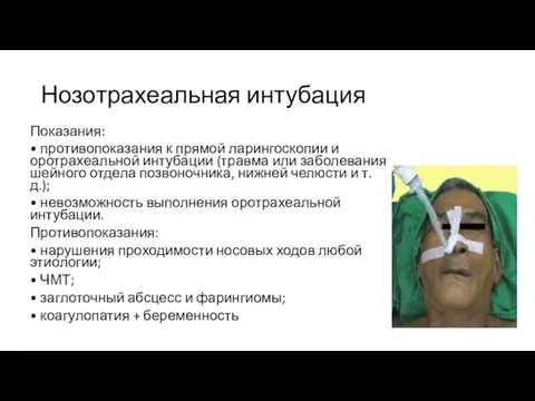 Нозотрахеальная интубация Показания: • противопоказания к прямой ларингоскопии и оротрахеальной интубации (травма