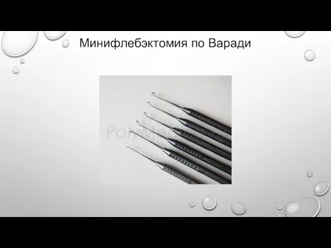 Минифлебэктомия по Варади